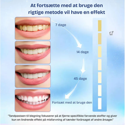 VitaLeende™ - Skræm misfarvninger væk. Smil med selvtillid.